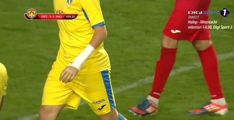 В матче Кубка Румынии принял участие 18-летний парень с протезом вместо руки (Фото) - изображение 1
