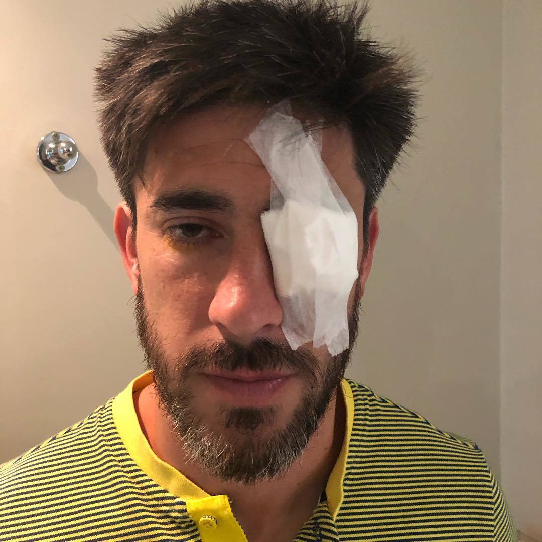 Фото дня: фанаты "Ривер Плейта" повредили глаз футболисту "Бока Хуниорс" - изображение 1