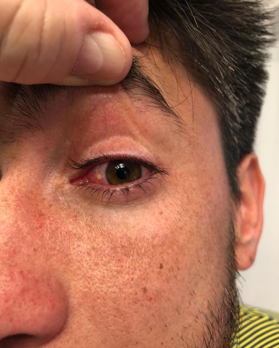 Фото дня: фанаты "Ривер Плейта" повредили глаз футболисту "Бока Хуниорс" - изображение 2