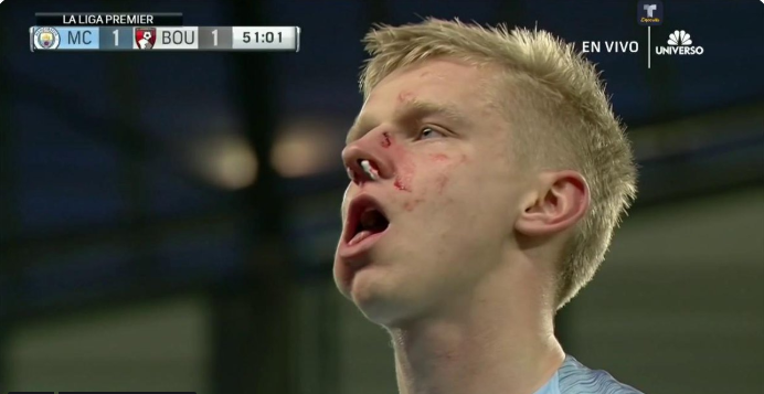 Александр Зинченко поучаствовал в голевой атаке и разбил нос в игре с "Борнмутом" (Фото) - изображение 1
