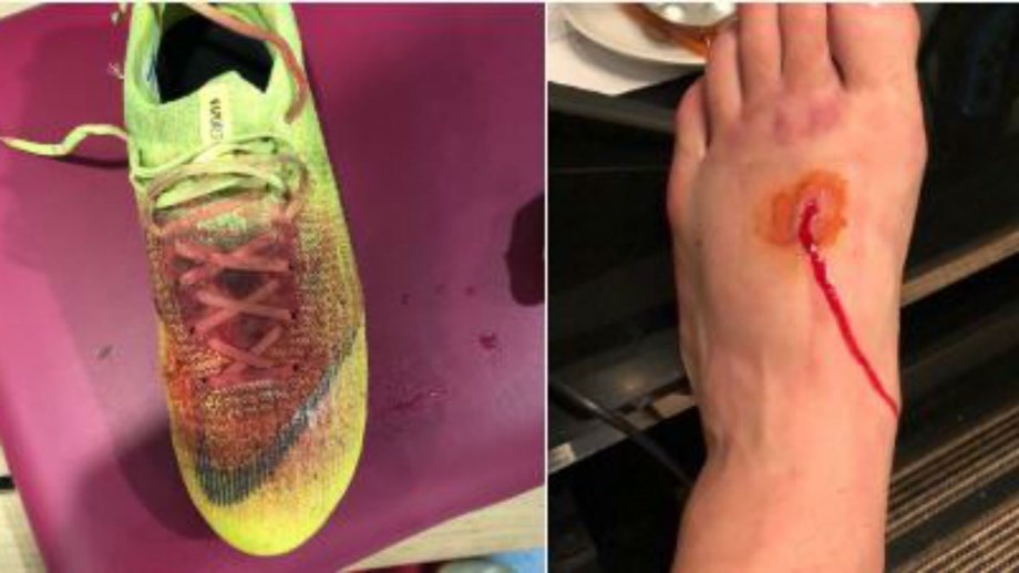 Лукас Перес показал ужасное повреждение в матче с "Кристал Пэлас" (Фото) - изображение 1
